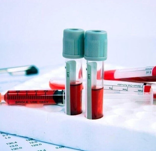 Αιματολογικές Εξετάσεις