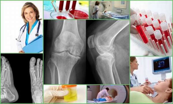 Διάγνωση της ρευματοειδούς αρθρίτιδας