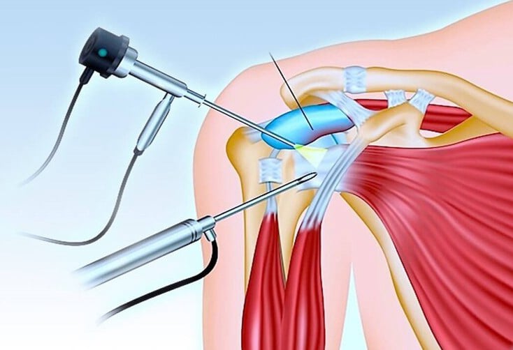 Ενδοσκοπικές επεμβάσεις