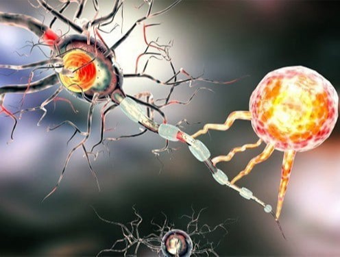 Συστηματική Σκλήρυνση