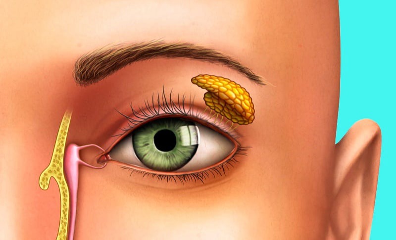 Νόσος του Sjögren